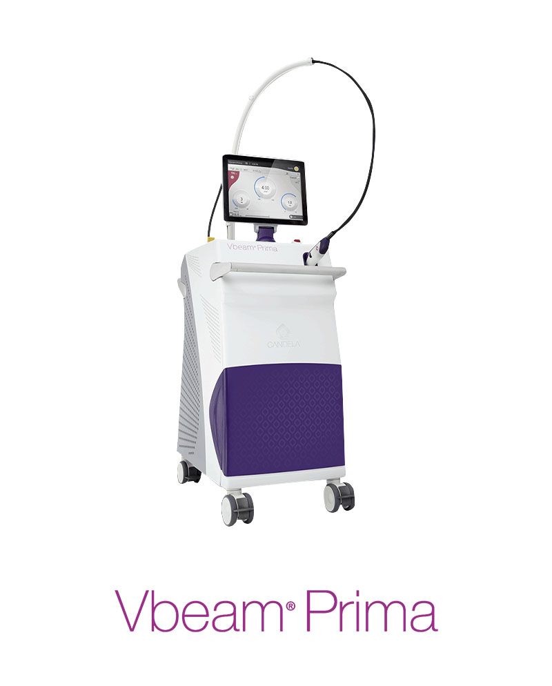 5 - Vbeam Prima