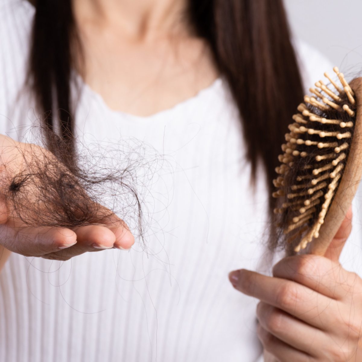 hair loss